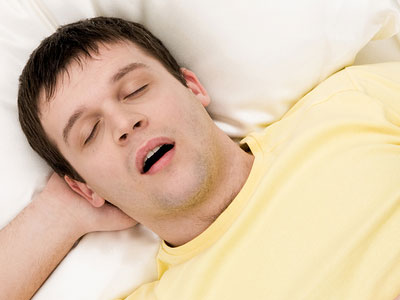 Sleep apnea Agoura Hills